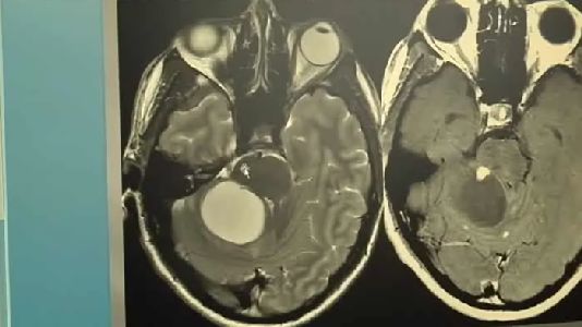 The Mystery of Von Hippel Lindau